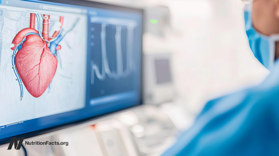 The Shocking Truth Behind Heart Stents: How Some Cardiologists Are Gaming the System for Profit