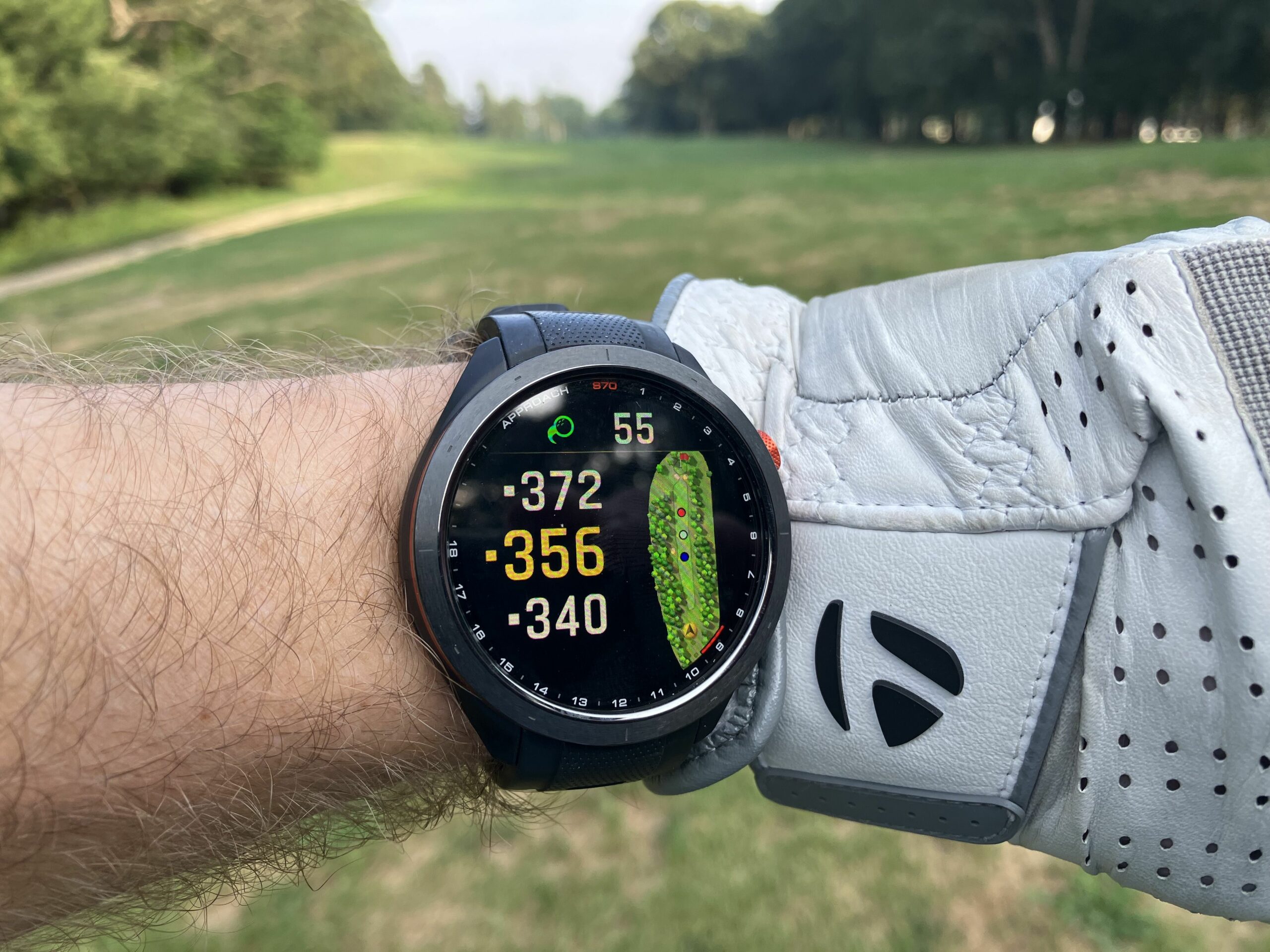 Why Every Serious Golfer Is Buzzing About the Garmin Approach S70—Is This the Game-Changer You’ve Been Waiting For?