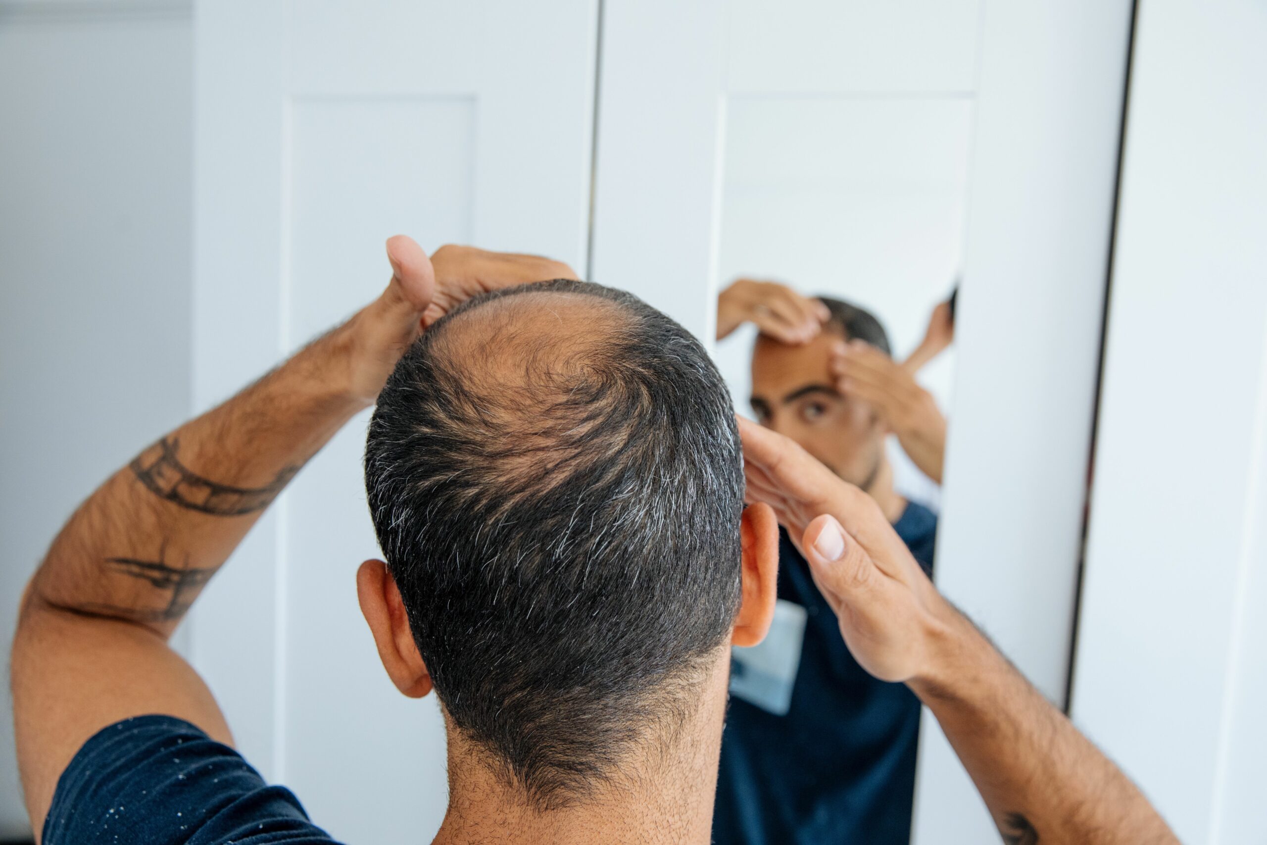 Could This Revolutionary New Drug Finally Unlock the Secret to Hair Regrowth and End Baldness Forever?