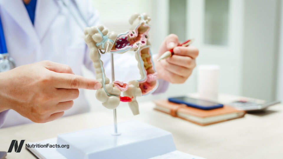 Is Your SIBO Test Actually Reliable? The Shocking Truth Behind What Your Results May Be Missing