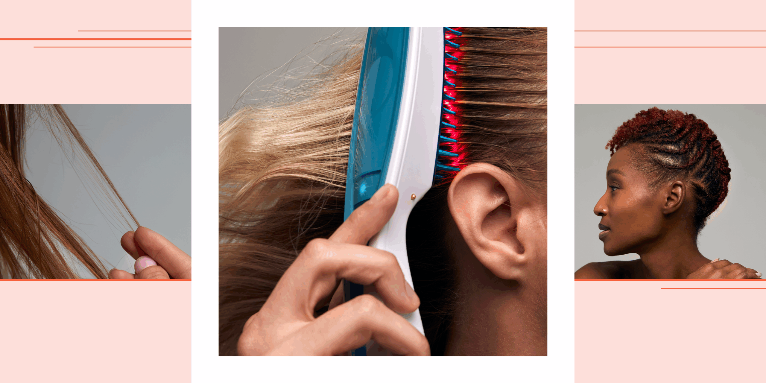 Unlocking the Hidden Truth: What Leading Experts Are Really Saying About Women’s Hair Loss—and How It Could Change Everything You Know!