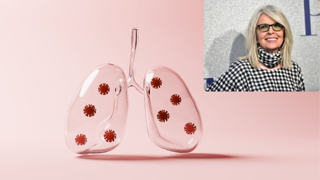 Diane Keaton’s Shocking Pneumonia Battle: When This Common Illness Turns Fatal—What Everyone Needs to Know Now