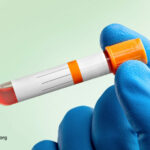 The Shocking Truth About Ideal vs. Normal Cholesterol Levels That Your Doctor Isn’t Telling You