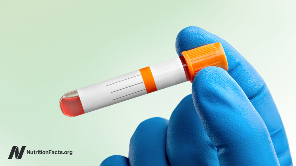 The Shocking Truth About Ideal vs. Normal Cholesterol Levels That Your Doctor Isn’t Telling You