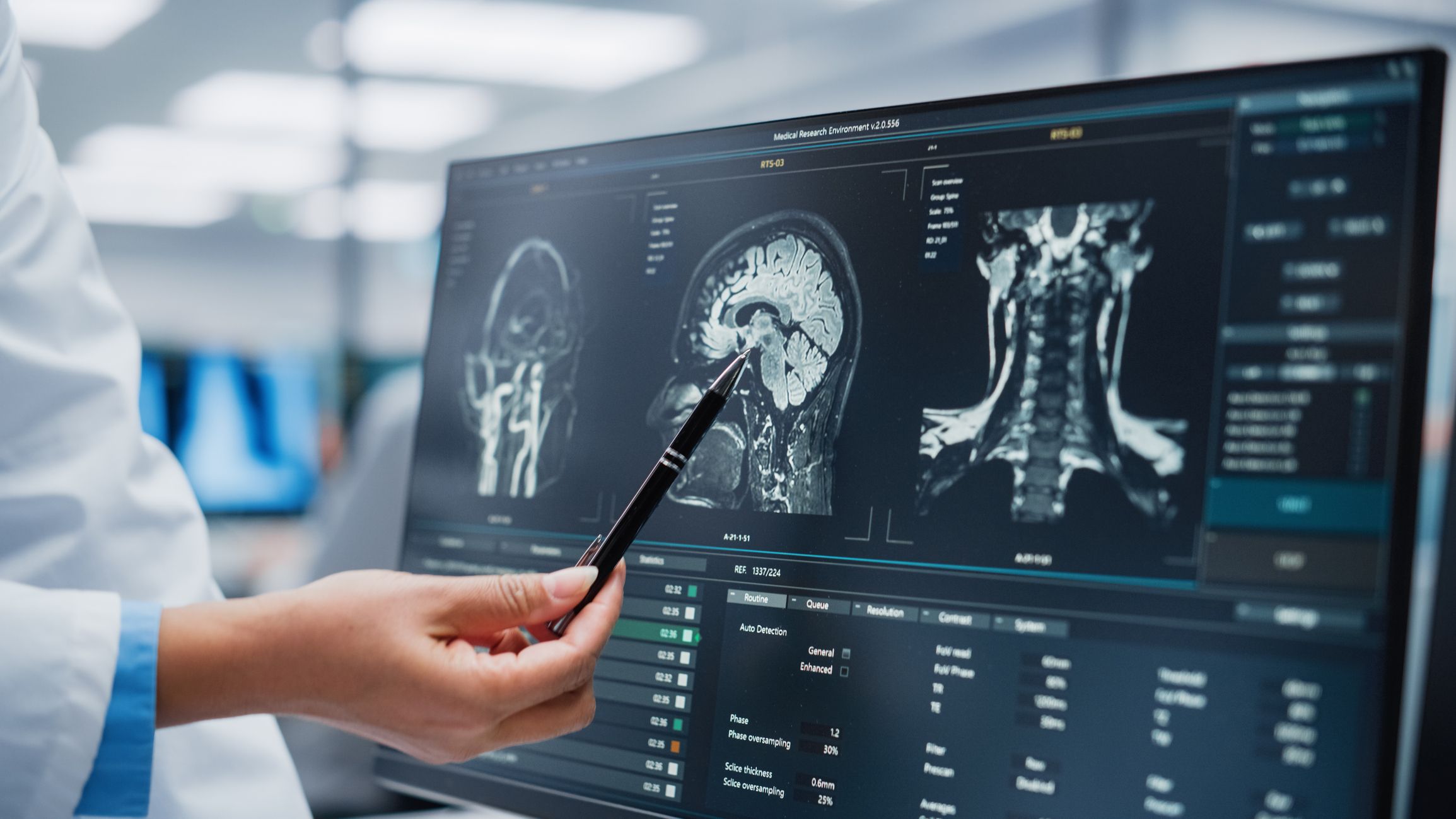 The Shocking Truth Behind Long COVID Brain Fog Scientists Were Hiding—And What It Means for Your Mind!