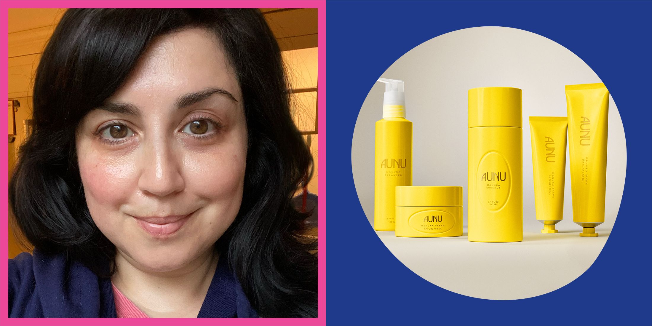 Unlock Radiant Skin in Just 4 Weeks: The Manuka Honey Secret No One Told You About!