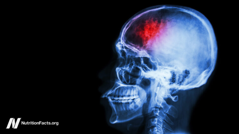 Unlock the Hidden Power of Fasting and Plant-Based Diets: The Surprising Remedy for Migraines and Traumatic Brain Injuries You’ve Never Heard Of