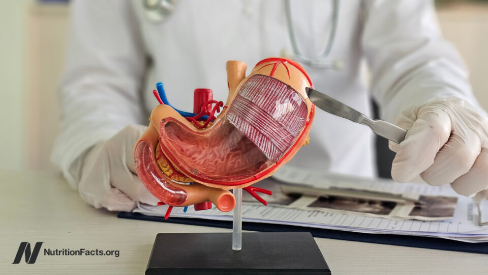 Bariatric Surgery’s Untold Price: What They’re Not Telling You About the Real Costs Beyond the Operating Room