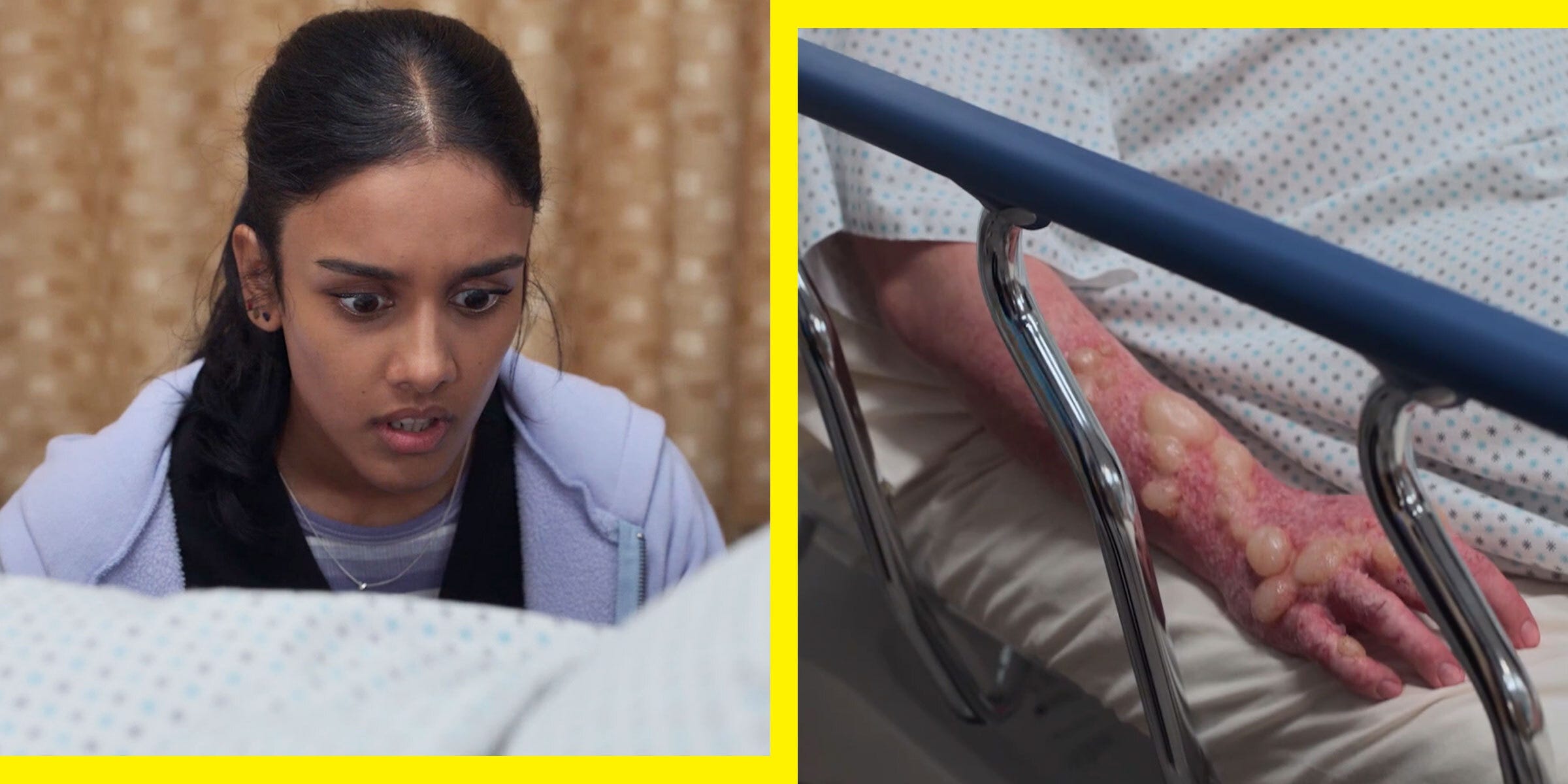 ER Doc Drops Truth Bomb on The Pitt’s Blister Outbreak—Here’s What You NEED to Know!