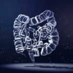 The Silent Threat: Why Colon Cancer Is Striking Millennials—and What You Can Do to Fight Back Now