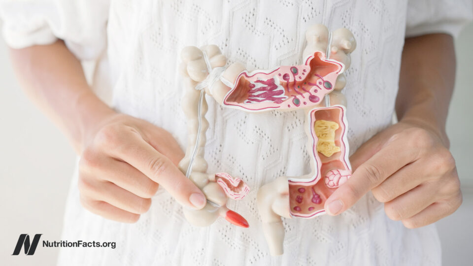 Unlock the Secret Superfoods That Could Heal Your Leaky Gut Faster Than You Think!