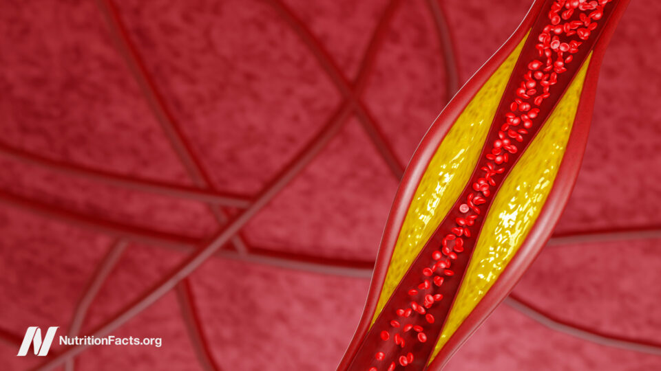 Unlocking the Mystery: How Far Can PCSK9 Inhibitors Really Drive Your LDL Cholesterol Down?