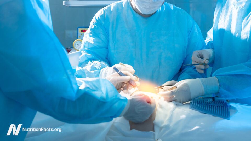 The Shocking Truth About Bariatric Surgery: Could It Be a Hidden Lifesaver or a Risk You Didn’t Expect?