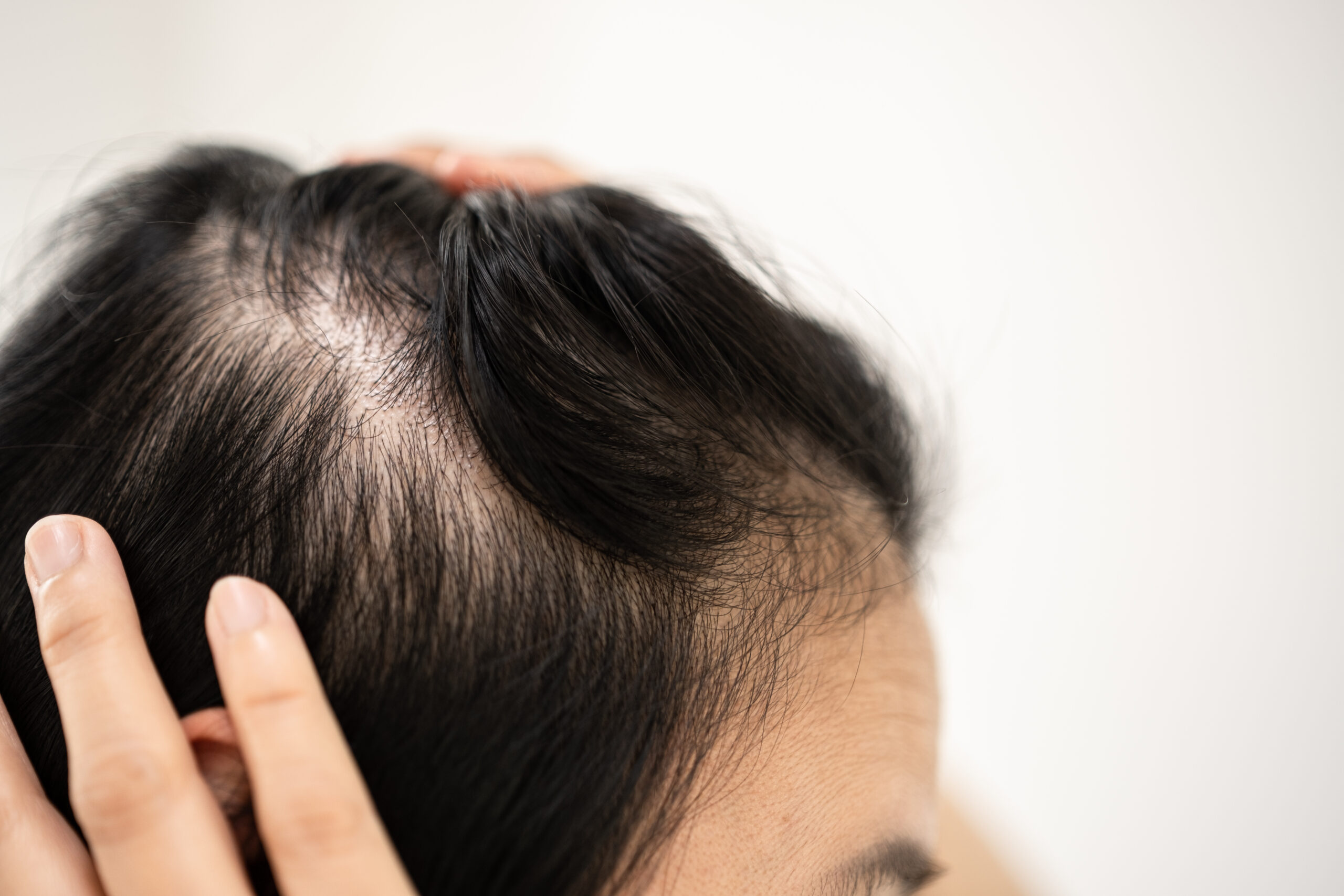 Unlock Costco’s Secret Weapons for Hair Growth That Even Experts Are Buzzing About—Are You Ready to Thicken Your Thinning Strands?