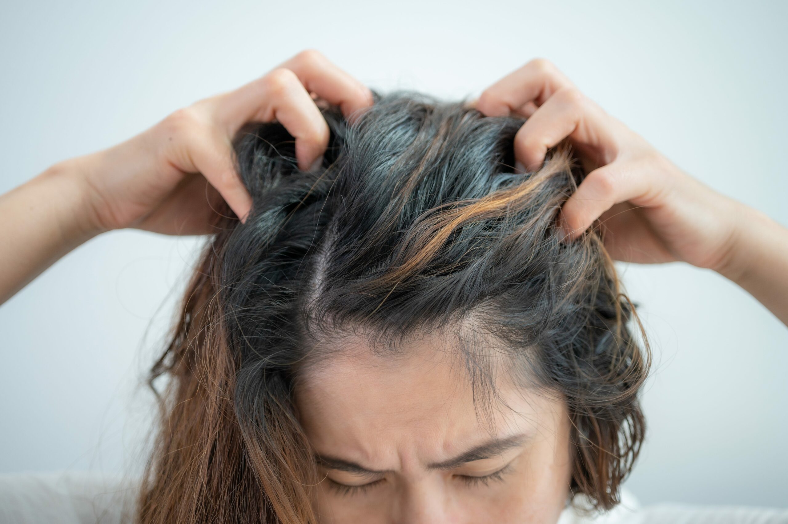 Unlock the Shocking Truth Behind Your Itchy Scalp – Dermatologists Reveal What’s Really Going On and How to Fix It Fast!