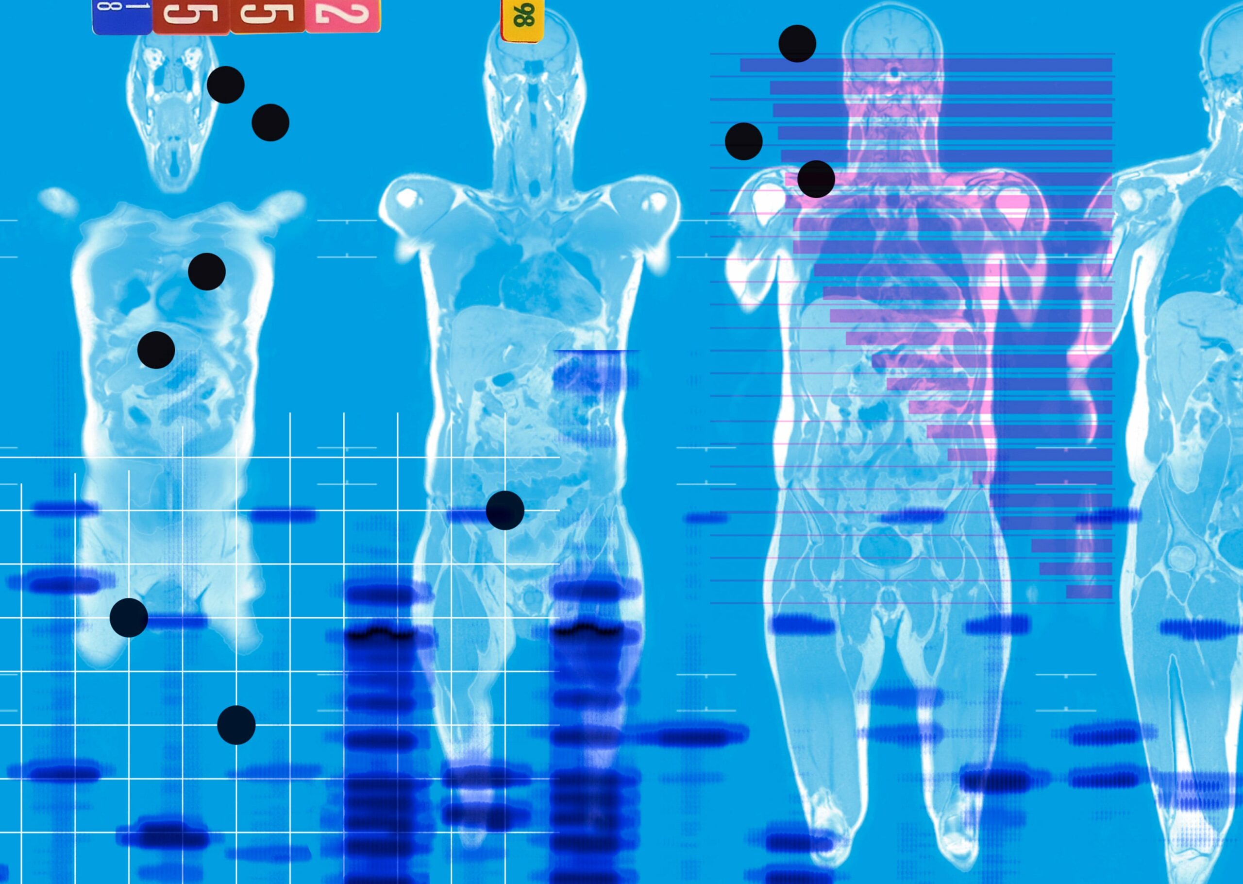 When Cancer Strikes Close to Home: The Shocking True Cost of Protecting Your Peace of Mind Revealed