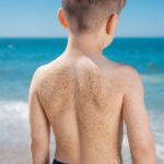 Unlock the Hidden Truth Behind Childhood Skin Rashes: What Every Parent and Entrepreneur Must Know Now