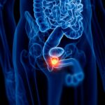 Unlock the Secret Moves Every Man Over 30 Must Know to Keep His Prostate Rock Solid—Doctors Don’t Always Tell You This!