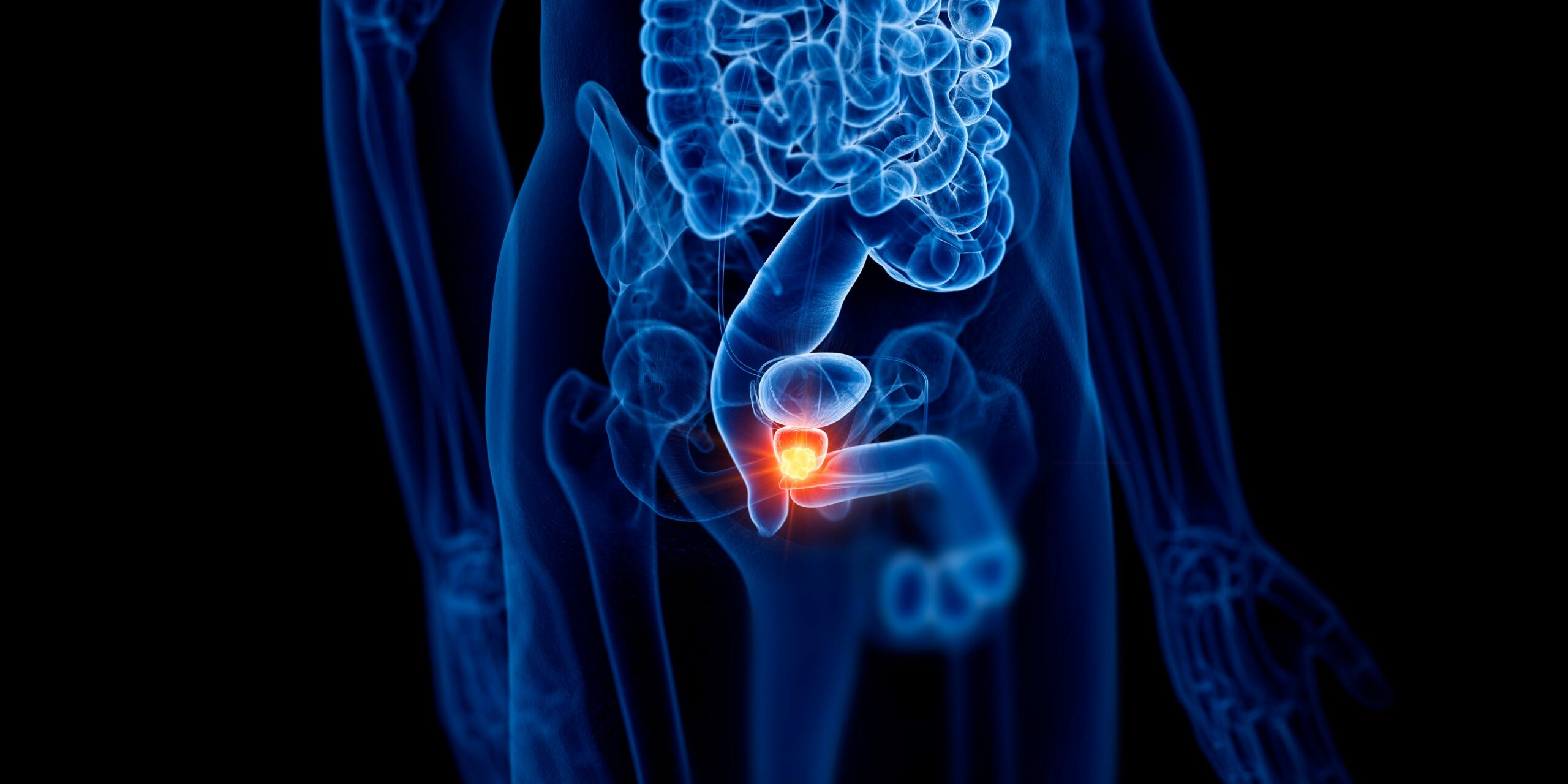 Unlock the Secret Moves Every Man Over 30 Must Know to Keep His Prostate Rock Solid—Doctors Don’t Always Tell You This!