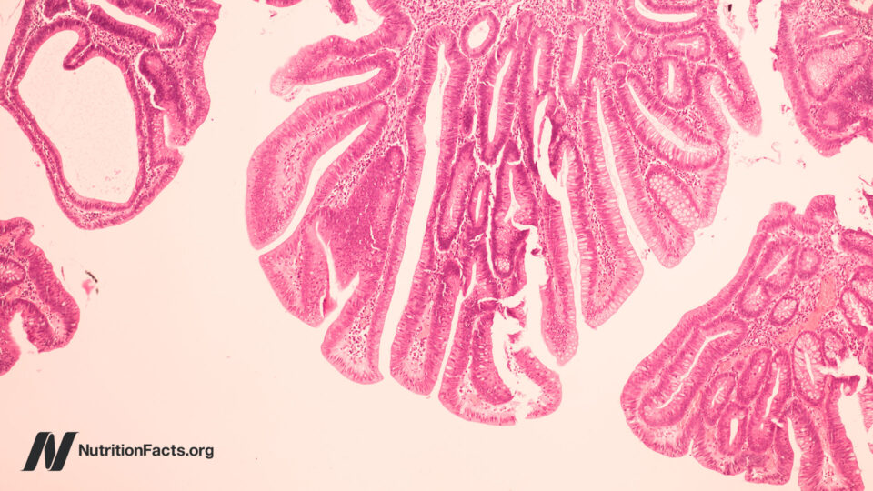 Is Bovine Leukemia Virus the Hidden Trigger Behind Rising Breast Cancer Rates?