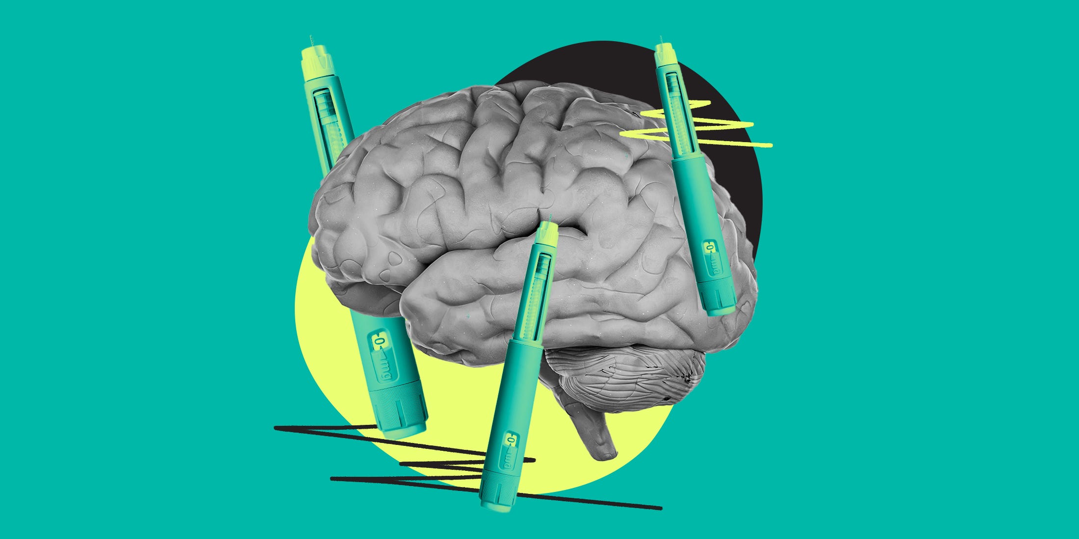 This Breakthrough in GLP-1 Research Could Change the Way We Fight Alzheimer’s Forever—Here’s What You Need to Know!