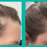 Unlock the Secret Weapon Against Stress and Hormone Hair Loss—Here’s What Happened When I Took These Capsules for 8 Weeks!