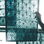 Could a Common Chemical in Your Home Be Quietly Raising Your Alzheimer's Risk? Here's What You Need to Know Now.