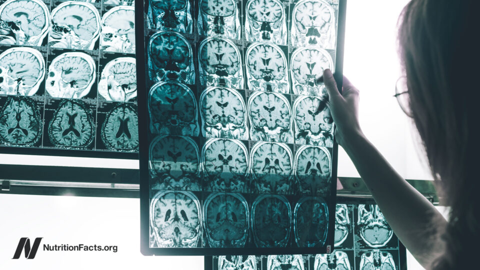Could a Common Chemical in Your Home Be Quietly Raising Your Alzheimer's Risk? Here's What You Need to Know Now.
