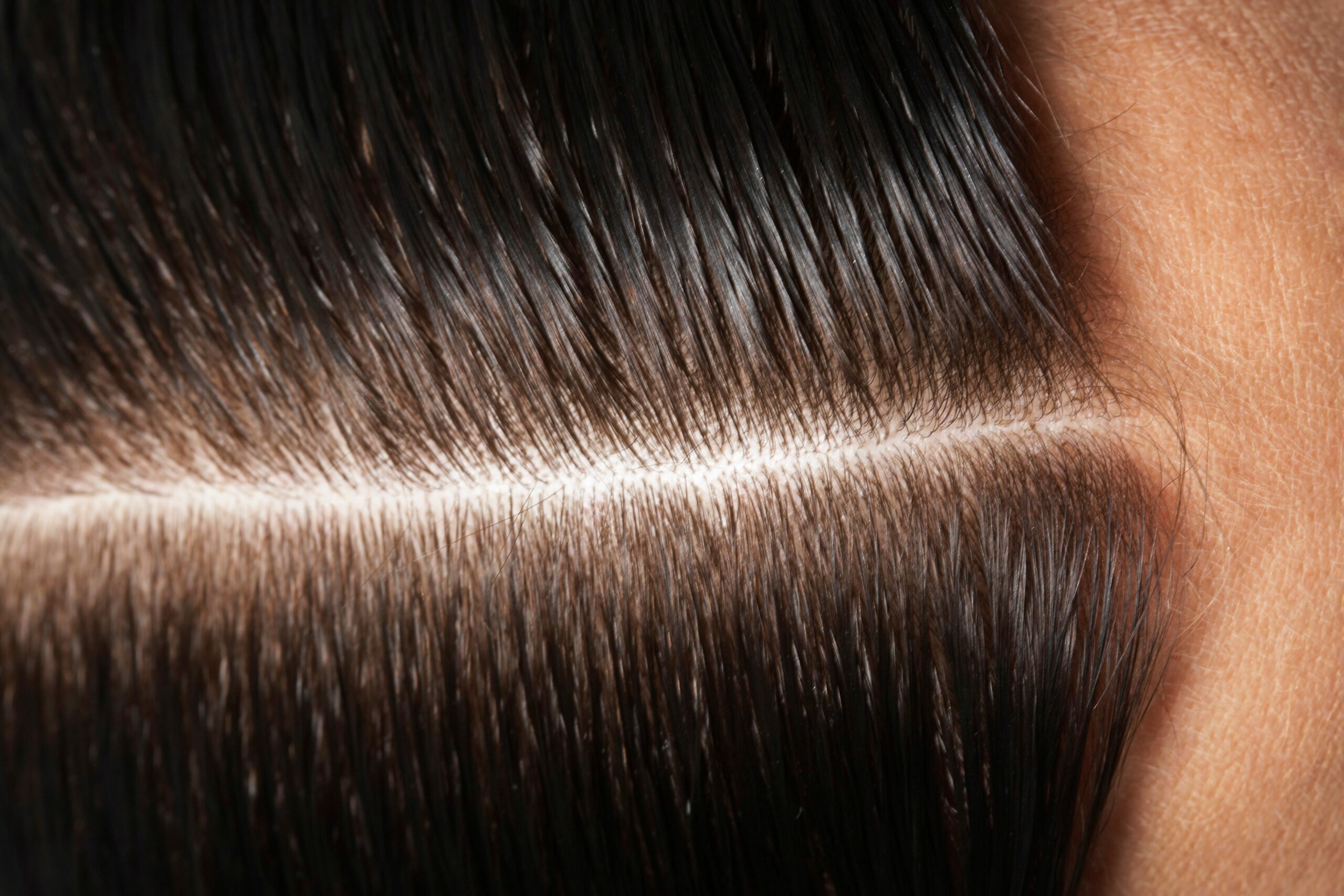Unlock the Hidden Power of Your Scalp’s ‘Micro-Zones’ for Jaw-Dropping Hair Growth You Didn’t Know You Needed
