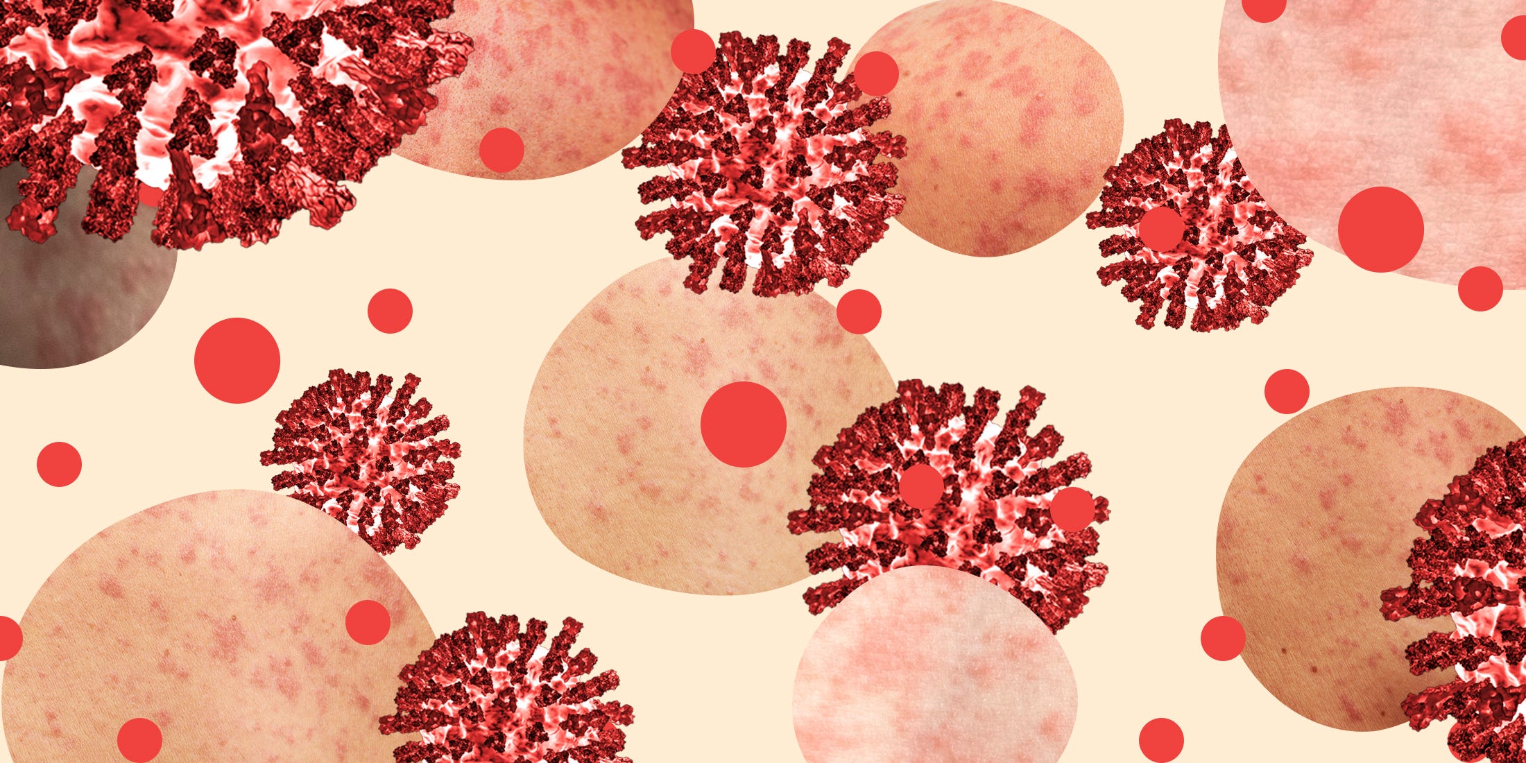 Deadly ‘Immune Amnesia’ Disease Is Spreading Fast in the U.S.—Here’s What You Need to Know to Protect Yourself Now