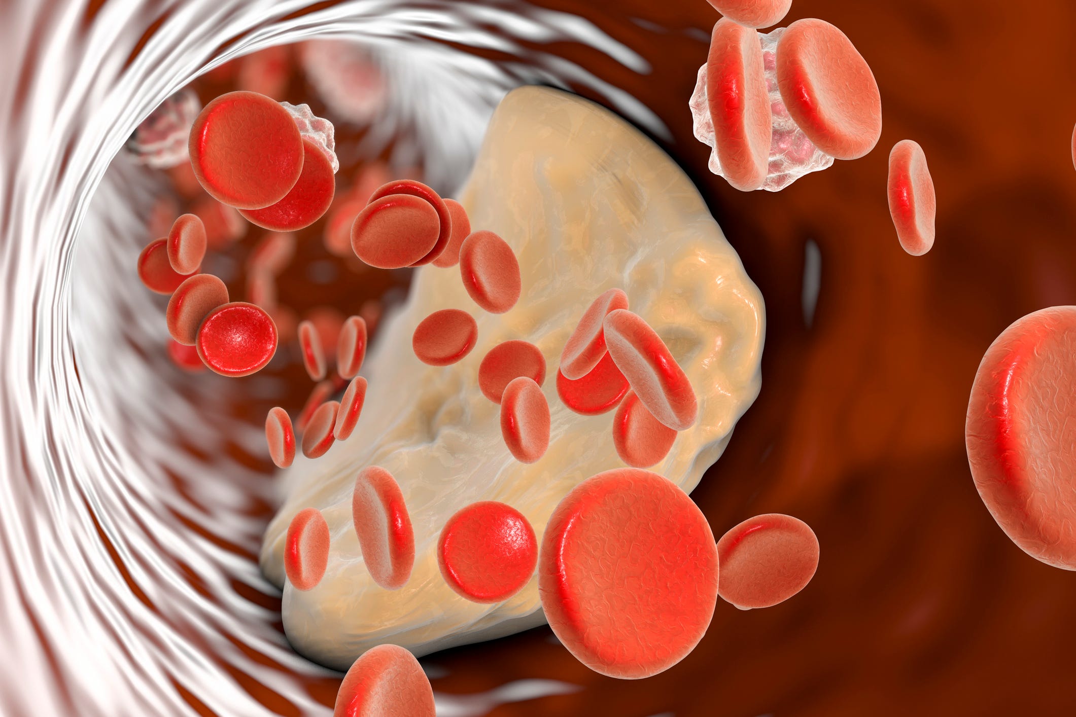 The One Surprising Test Cardiologists Swear By to Reveal Your True Cholesterol Risk—Are You Missing It?