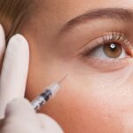 Could Botox Be the Unexpected Acne Game-Changer Dermatologists Didn’t See Coming?