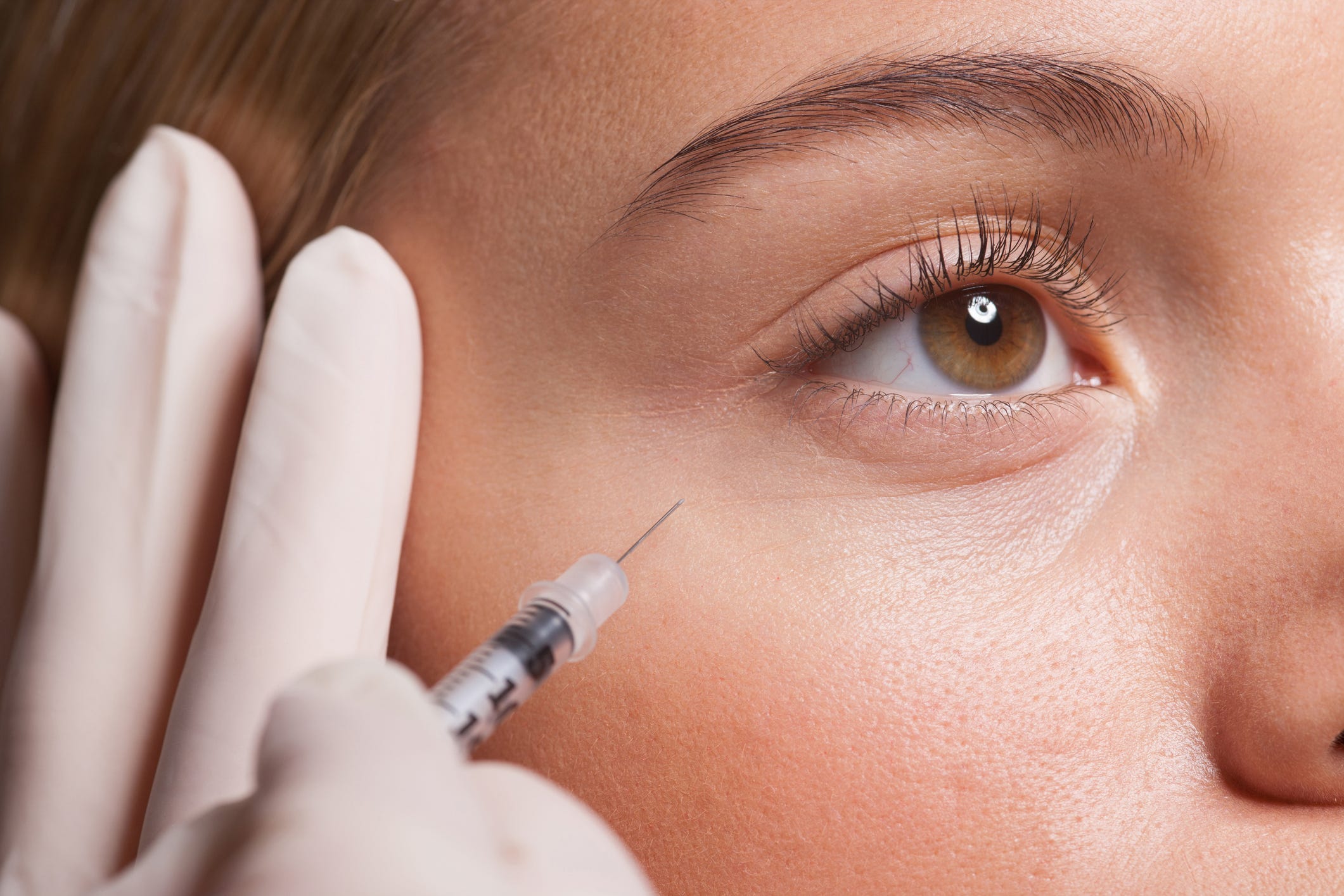 Could Botox Be the Unexpected Acne Game-Changer Dermatologists Didn’t See Coming?