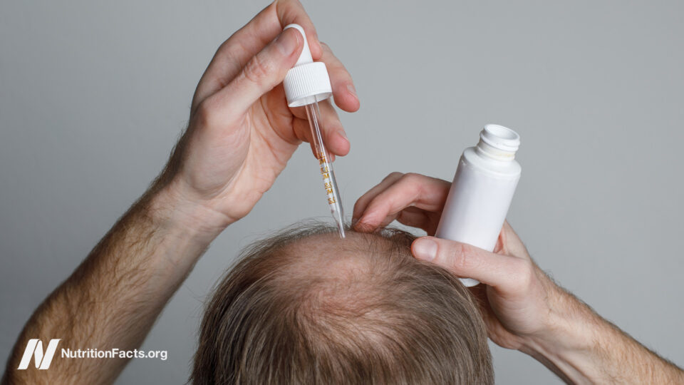 Hair Loss Drugs: The Surprising Truth Behind Their Promised Gains and Hidden Dangers You Need to Know Now