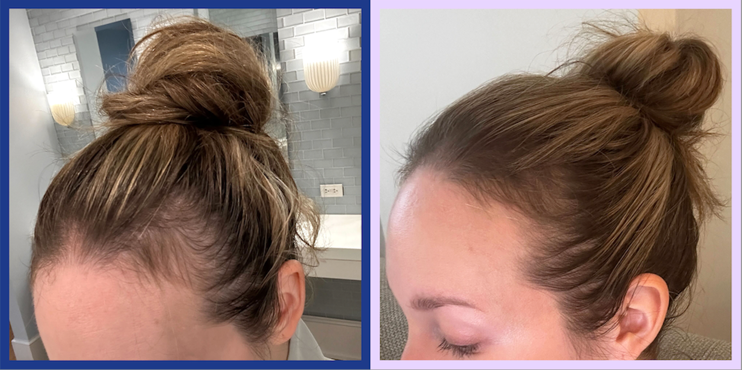 Unlock the Secret to Lush, Thick Hair: 7 Expert-Backed Supplements That Actually Work (Number 4 Will Surprise You!)