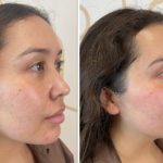 Unlock the Secret Korean Skin Treatment Everyone’s Obsessed With—Xerf Could Change Your Glow Forever!