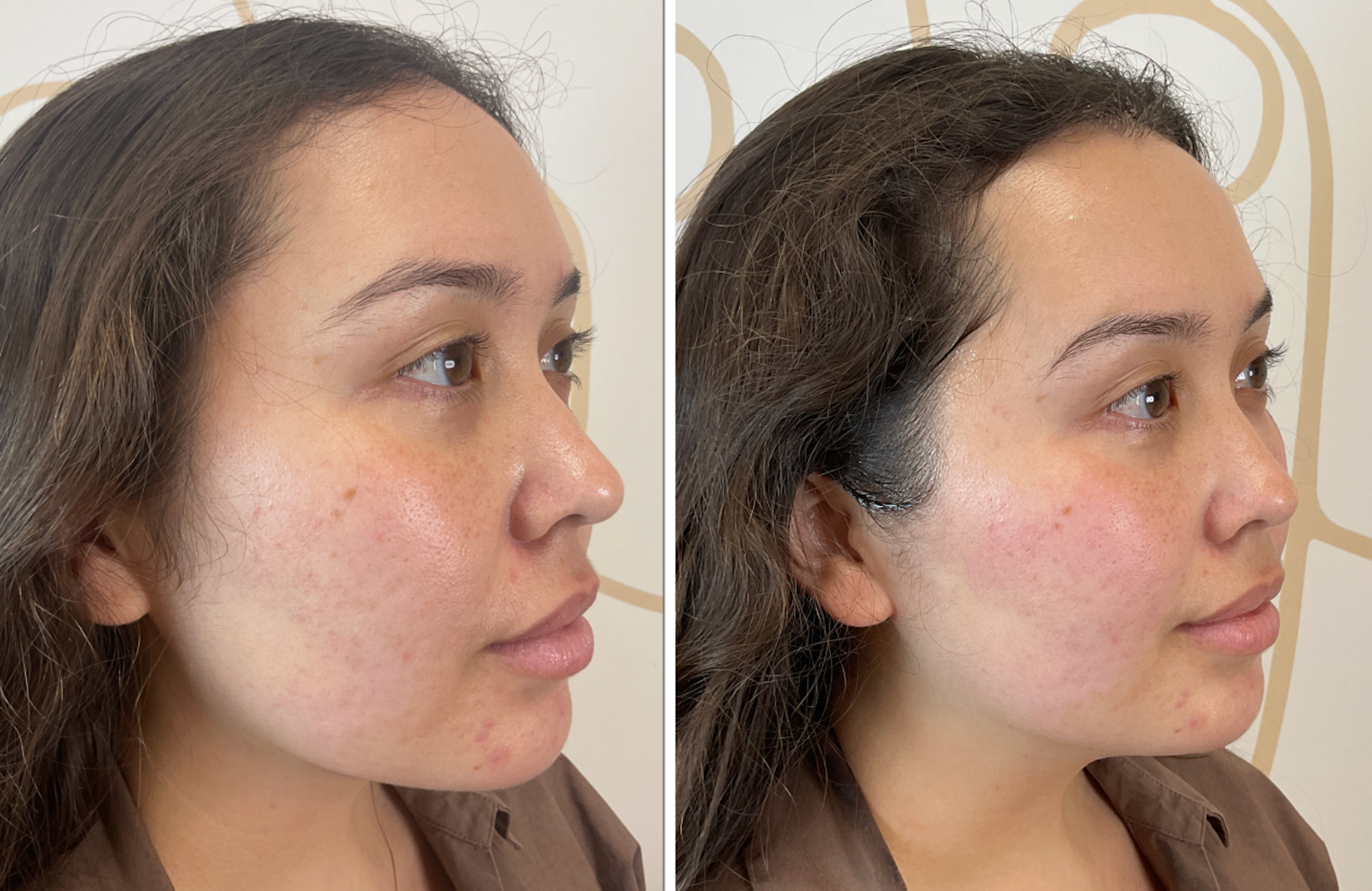 Unlock the Secret Korean Skin Treatment Everyone’s Obsessed With—Xerf Could Change Your Glow Forever!