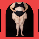 Discover the Shocking Painful Condition Affecting Millions of Women—Why No One’s Talking About It!